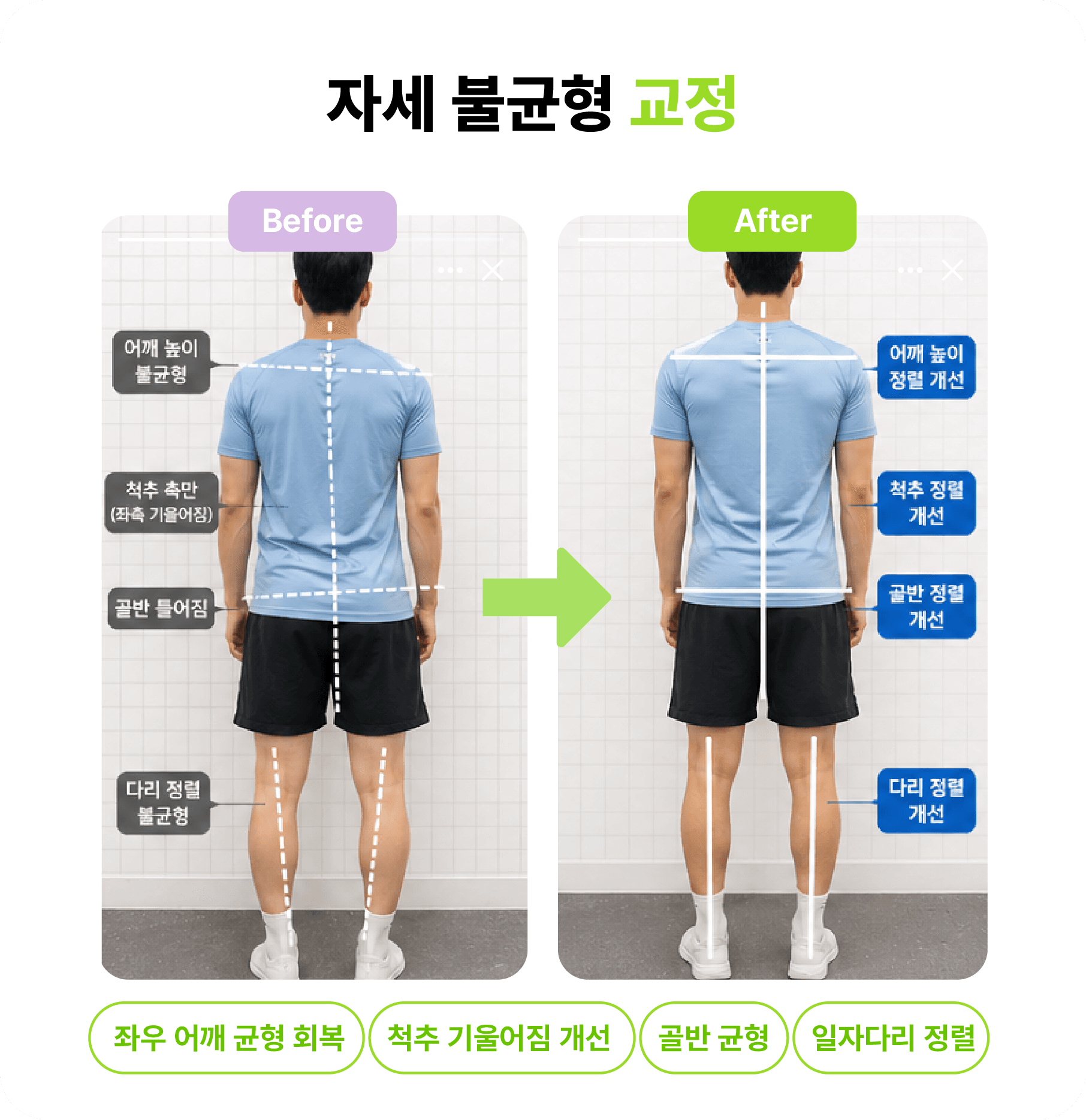 12주 변화 비교 전후 사진 3