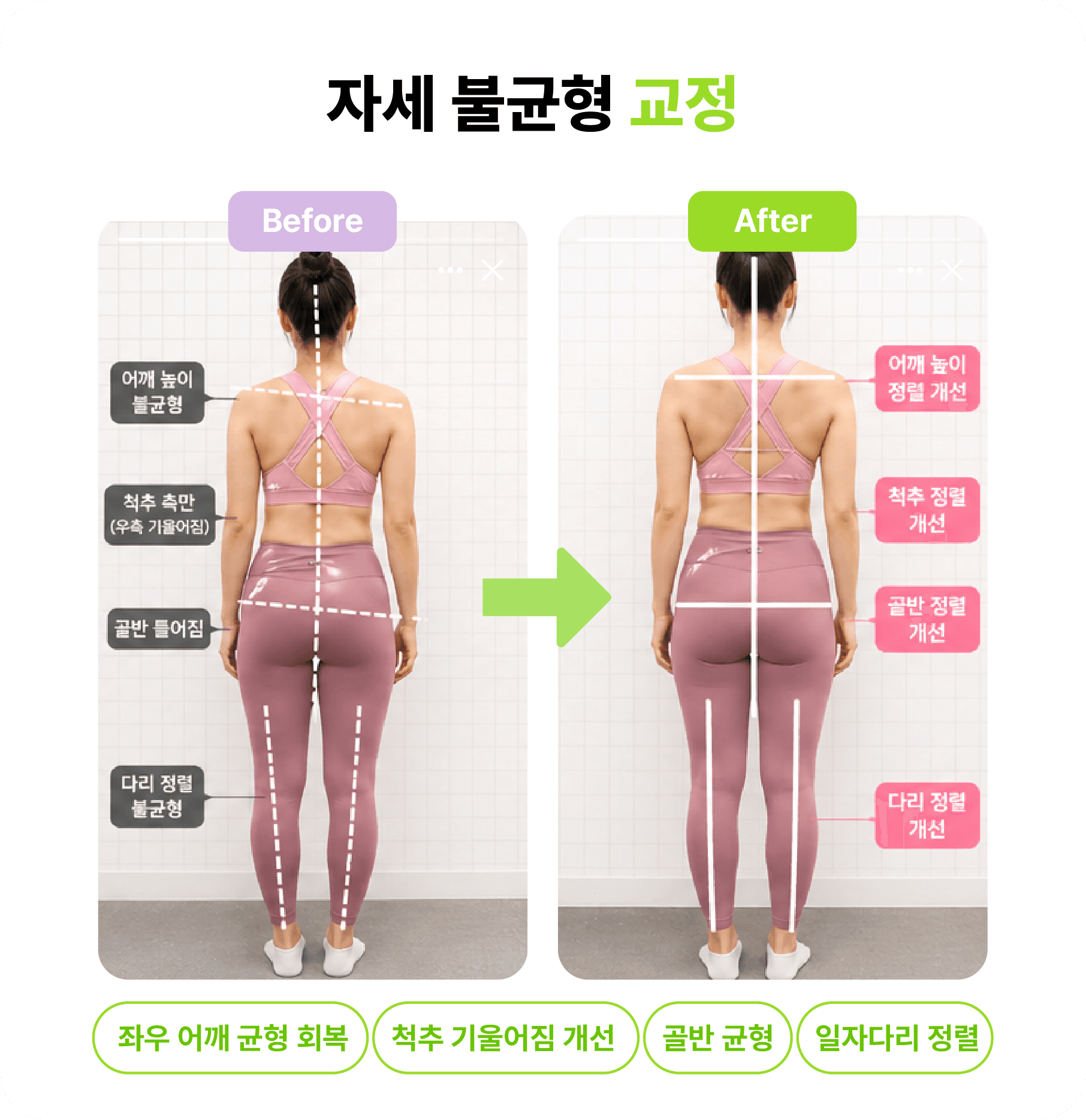12주 변화 비교 전후 사진 4